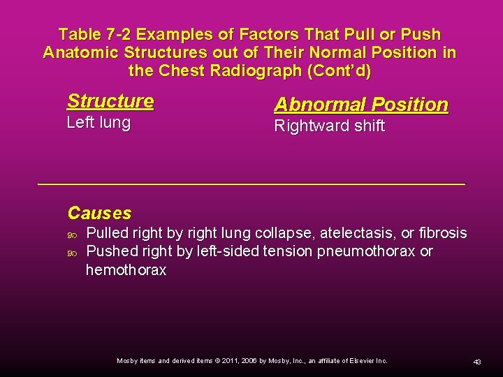 Table 7 -2 Examples of Factors That Pull or Push Anatomic Structures out of