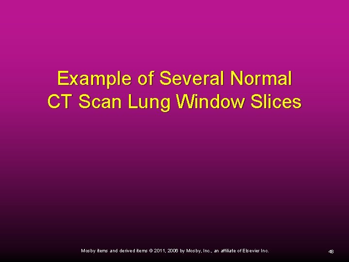 Example of Several Normal CT Scan Lung Window Slices Mosby items and derived items