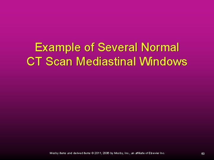 Example of Several Normal CT Scan Mediastinal Windows Mosby items and derived items ©