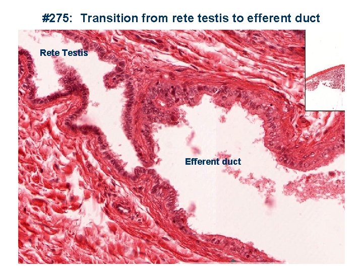 #275: Transition from rete testis to efferent duct Rete Testis Efferent duct 