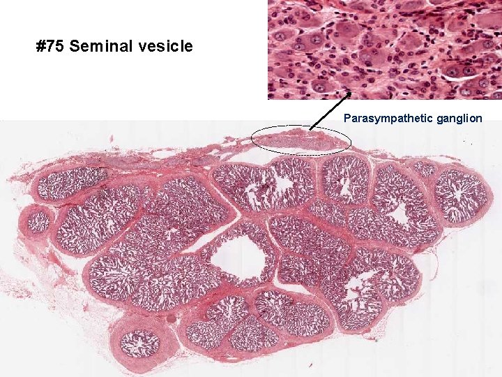 #75 Seminal vesicle Parasympathetic ganglion 