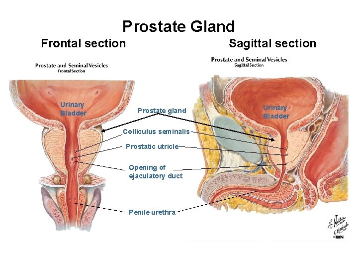 Prostate Gland Frontal section Urinary Bladder Sagittal section Prostate gland Colliculus seminalis Prostatic utricle