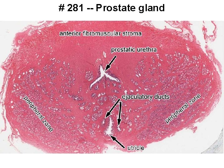 # 281 -- Prostate gland 