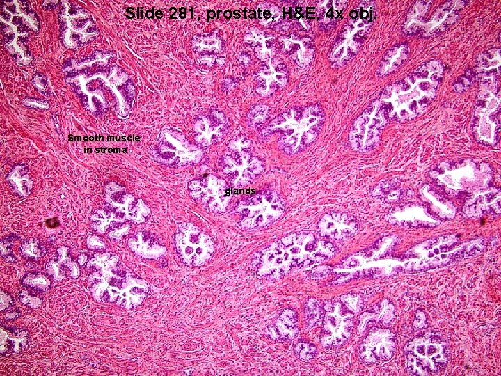 Slide 281, prostate, H&E, 4 x obj. Smooth muscle in stroma glands 