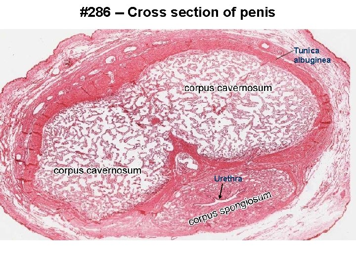 #286 -- Cross section of penis Tunica albuginea Urethra 