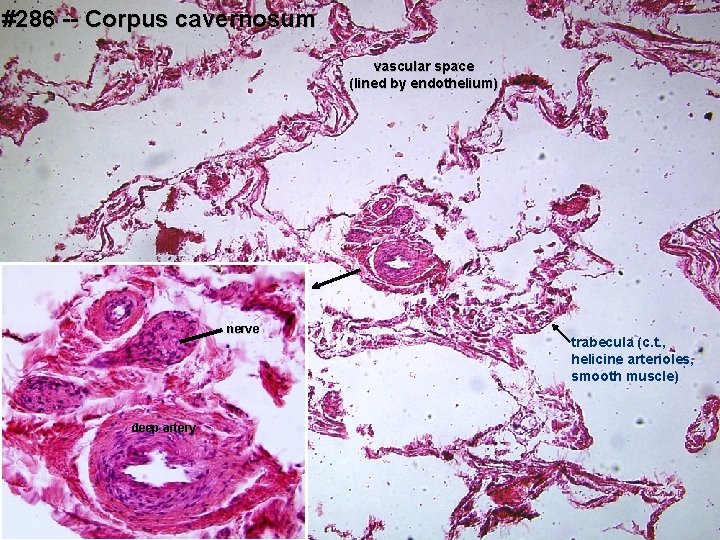 #286 -- Corpus cavernosum vascular space (lined by endothelium) nerve deep artery trabecula (c.