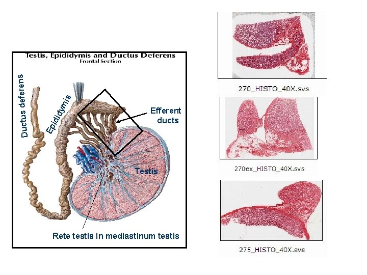 Ep id idy mi s s Ductus deferen Efferent ducts Testis Rete testis in