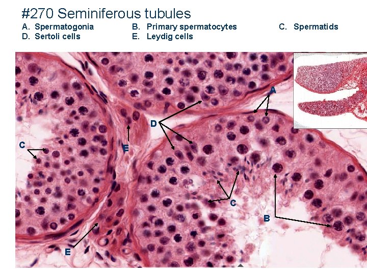 #270 Seminiferous tubules A. Spermatogonia D. Sertoli cells B. Primary spermatocytes E. Leydig cells