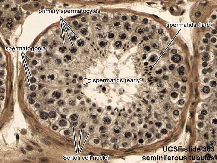 UCSF slide 363 seminiferous tubules 