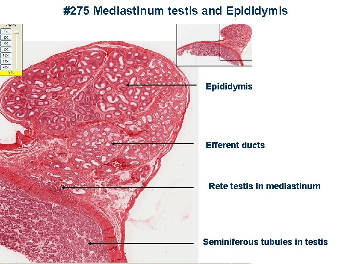 #275 Mediastinum testis and Epididymis Efferent ducts Rete testis in mediastinum Seminiferous tubules in