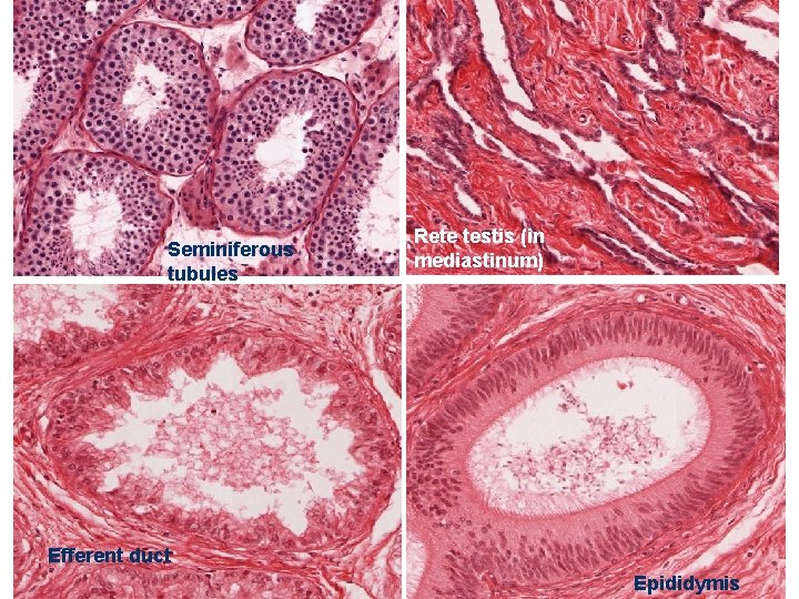 Seminiferous tubules Rete testis (in mediastinum) Efferent duct Epididymis 