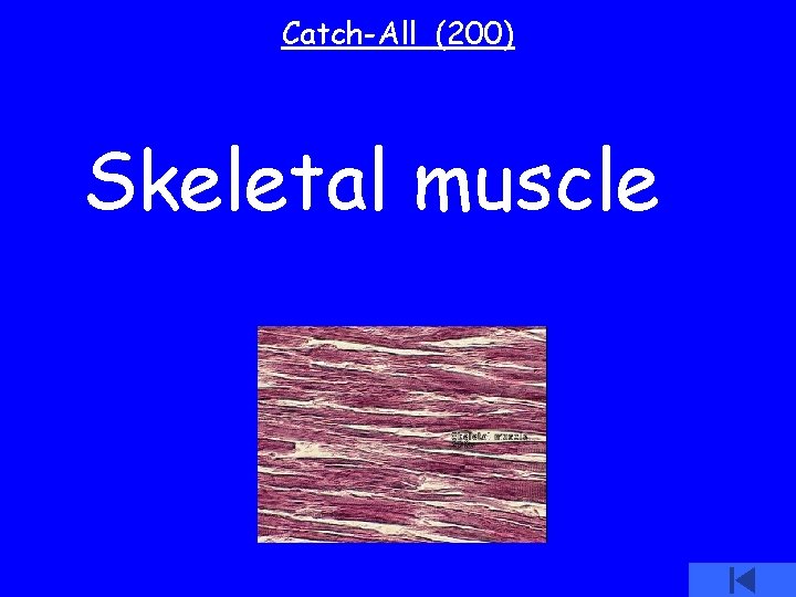 Catch-All (200) Skeletal muscle 