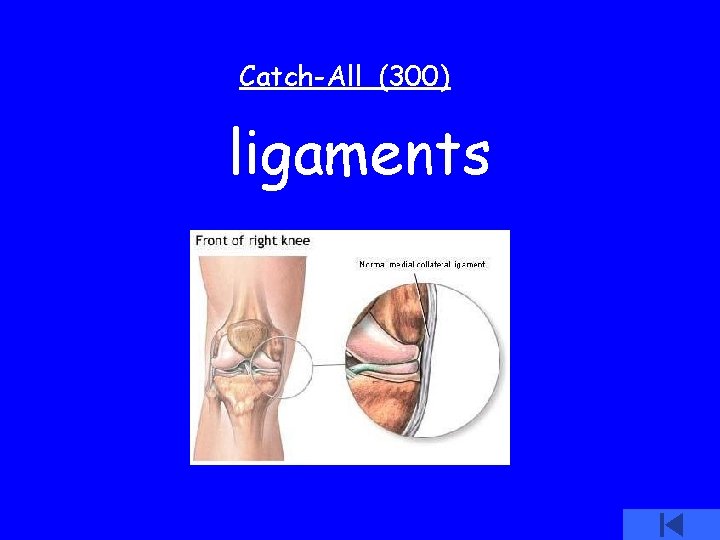 Catch-All (300) ligaments 