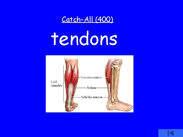 Catch-All (400) tendons 