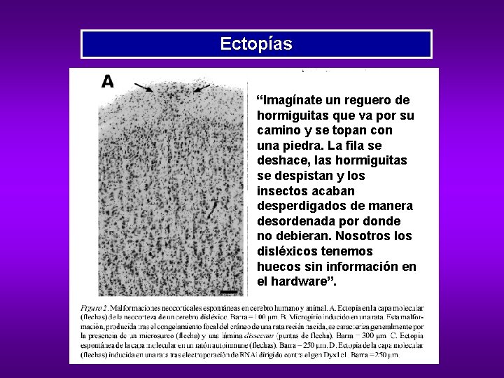 Ectopías “Imagínate un reguero de hormiguitas que va por su camino y se topan