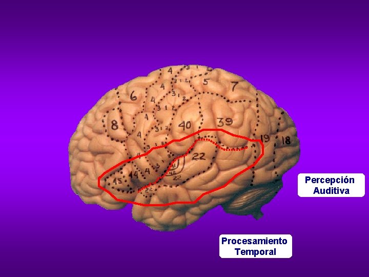 Percepción Auditiva Procesamiento Temporal 