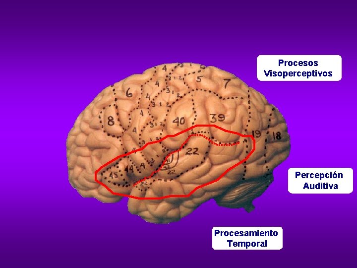 Procesos Visoperceptivos Percepción Auditiva Procesamiento Temporal 