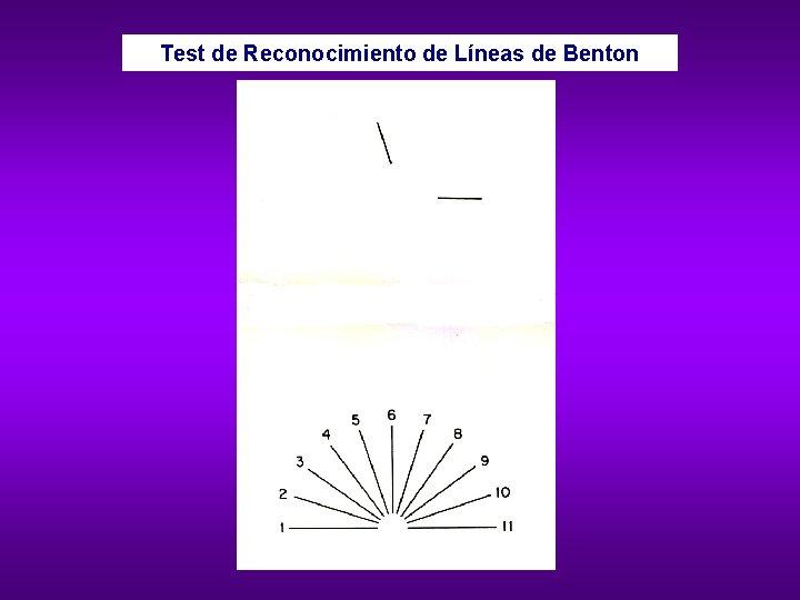 Test de Reconocimiento de Líneas de Benton 