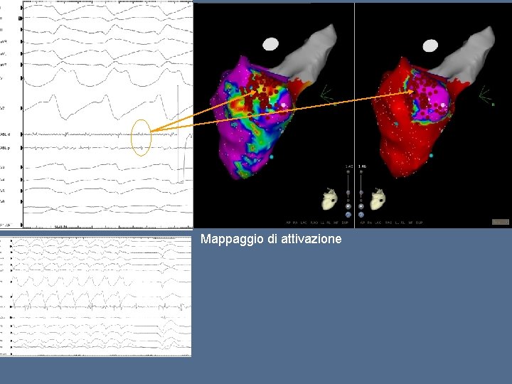 Mappaggio di attivazione 