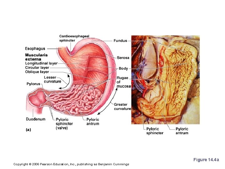 Stomach Anatomy Figure 14. 4 a Copyright © 2006 Pearson Education, Inc. , publishing