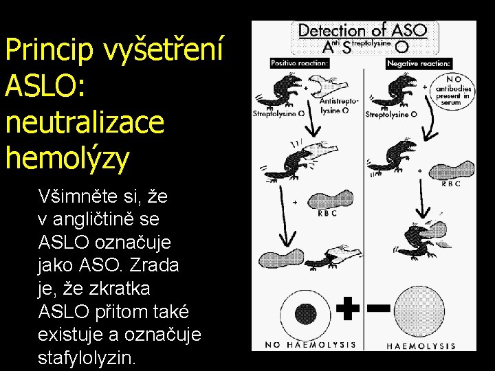 Princip vyšetření ASLO: neutralizace hemolýzy Všimněte si, že v. angličtině se ASLO označuje jako