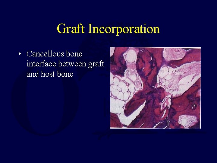 Graft Incorporation • Cancellous bone interface between graft and host bone 