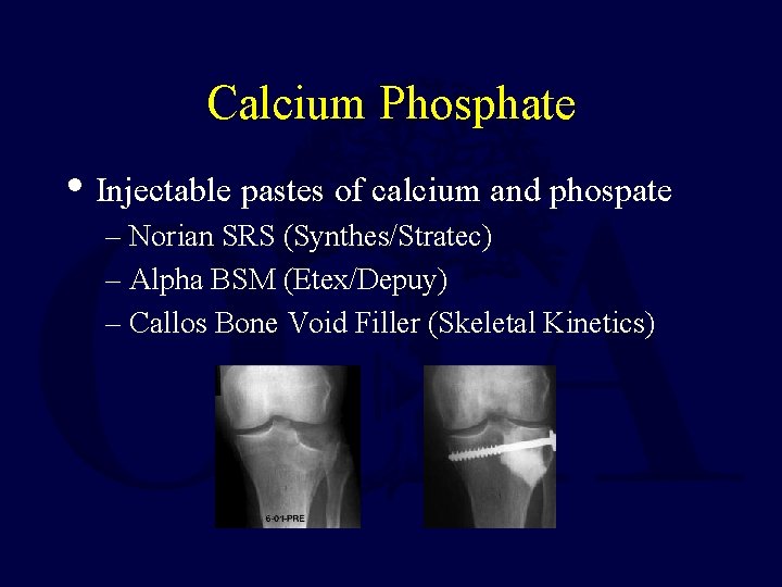 Calcium Phosphate • Injectable pastes of calcium and phospate – Norian SRS (Synthes/Stratec) –