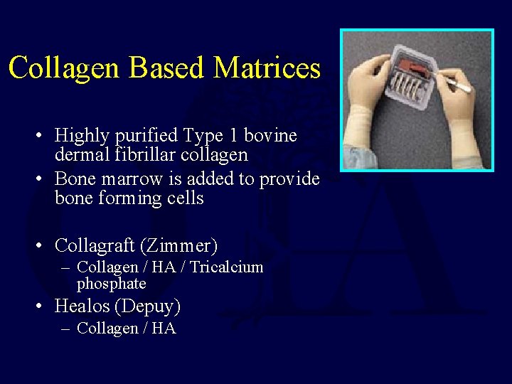 Collagen Based Matrices • Highly purified Type 1 bovine dermal fibrillar collagen • Bone