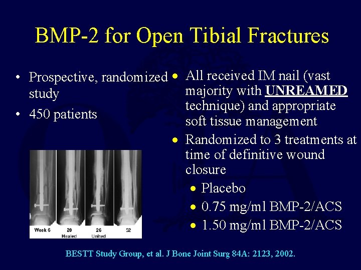 BMP-2 for Open Tibial Fractures • Prospective, randomized · study • 450 patients All