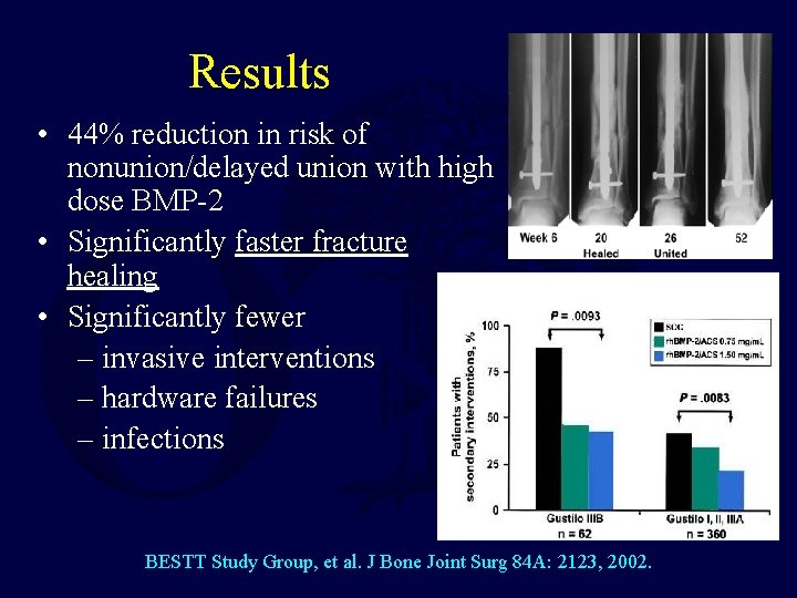 Results • 44% reduction in risk of nonunion/delayed union with high dose BMP-2 •