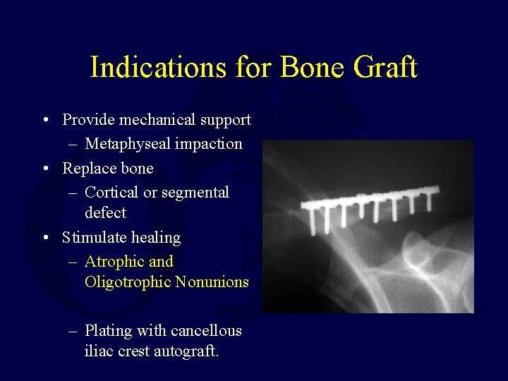 Indications for Bone Graft • Provide mechanical support – Metaphyseal impaction • Replace bone