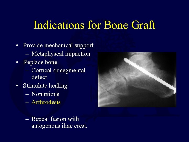 Indications for Bone Graft • Provide mechanical support – Metaphyseal impaction • Replace bone