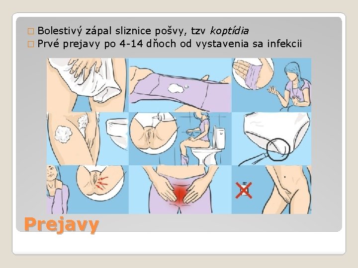 � Bolestivý zápal sliznice pošvy, tzv koptídia � Prvé prejavy po 4 -14 dňoch