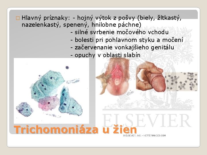 � Hlavný príznaky: - hojný výtok z pošvy (biely, žltkastý, nazelenkastý, spenený, hnilobne páchne)