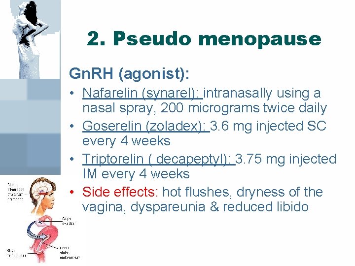 2. Pseudo menopause Gn. RH (agonist): • Nafarelin (synarel): intranasally using a nasal spray,