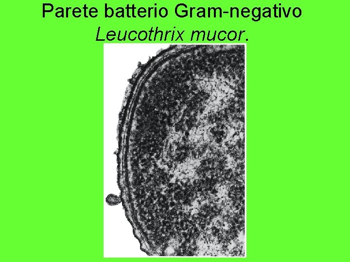 Parete batterio Gram-negativo Leucothrix mucor. 