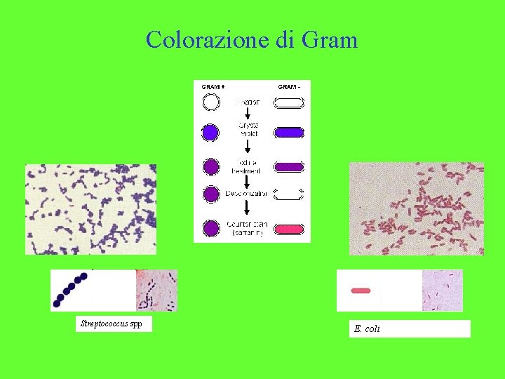 Colorazione di Gram Streptococcus spp E. coli 