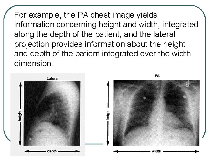 For example, the PA chest image yields information concerning height and width, integrated along For example, the PA chest image yields information concerning height and width, integrated along