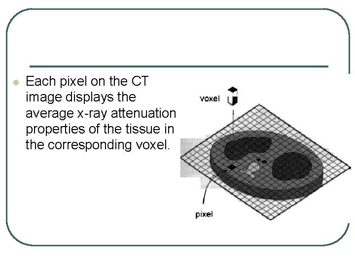l Each pixel on the CT image displays the average x-ray attenuation properties of l Each pixel on the CT image displays the average x-ray attenuation properties of