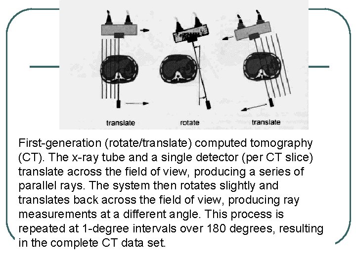 First-generation (rotate/translate) computed tomography (CT). The x-ray tube and a single detector (per CT First-generation (rotate/translate) computed tomography (CT). The x-ray tube and a single detector (per CT