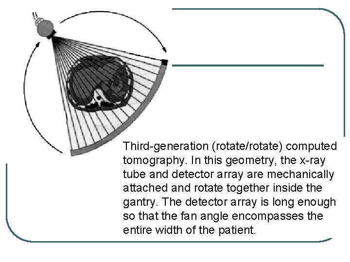 Third-generation (rotate/rotate) computed tomography. In this geometry, the x-ray tube and detector array are Third-generation (rotate/rotate) computed tomography. In this geometry, the x-ray tube and detector array are