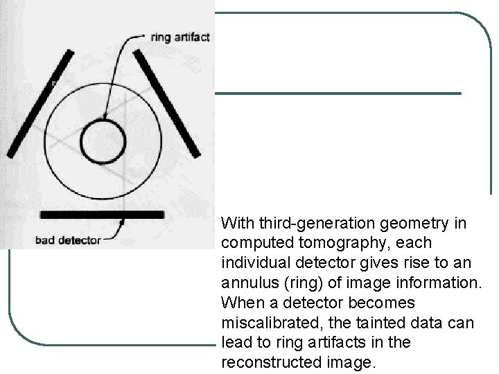 With third-generation geometry in computed tomography, each individual detector gives rise to an annulus With third-generation geometry in computed tomography, each individual detector gives rise to an annulus