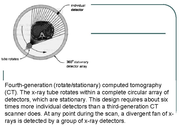 Fourth-generation (rotate/stationary) computed tomography (CT). The x-ray tube rotates within a complete circular array Fourth-generation (rotate/stationary) computed tomography (CT). The x-ray tube rotates within a complete circular array