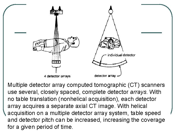 Multiple detector array computed tomographic (CT) scanners use several, closely spaced, complete detector arrays. Multiple detector array computed tomographic (CT) scanners use several, closely spaced, complete detector arrays.