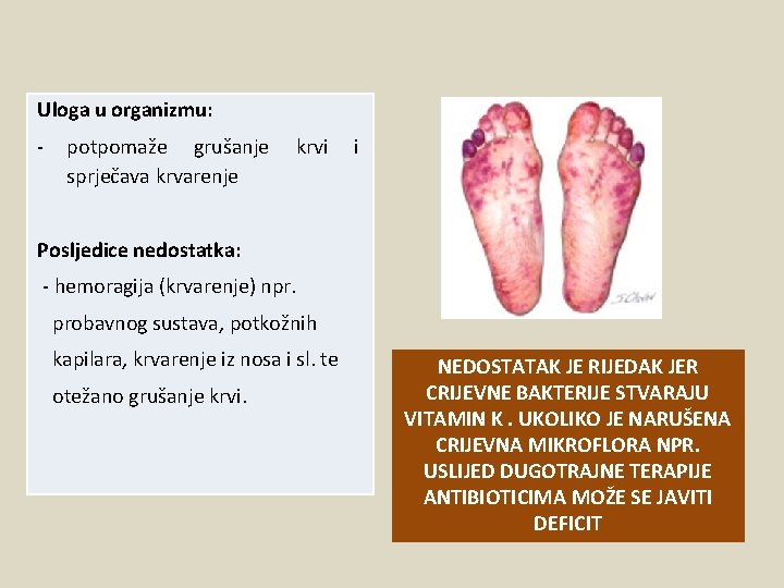 Uloga u organizmu: - potpomaže grušanje sprječava krvarenje krvi i Posljedice nedostatka: - hemoragija