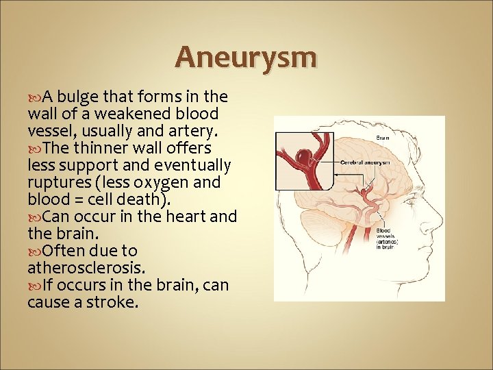 Aneurysm A bulge that forms in the wall of a weakened blood vessel, usually