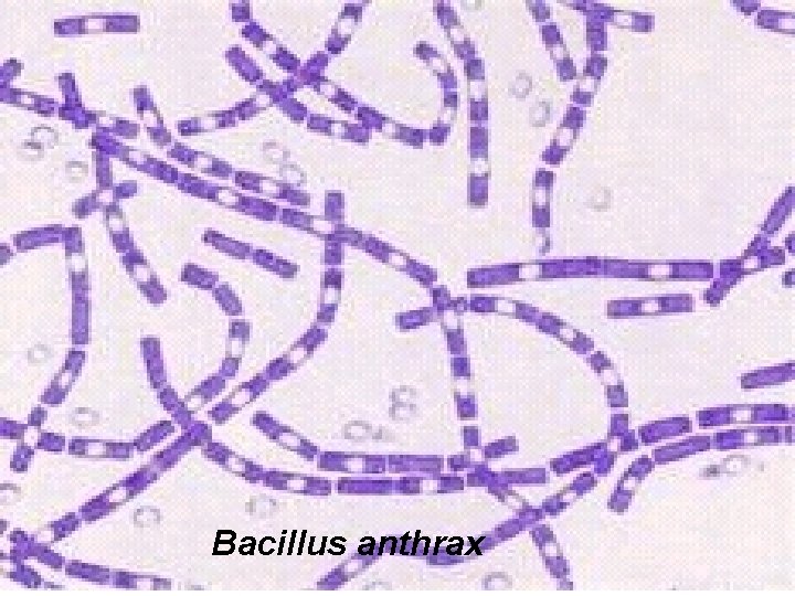 Bacillus anthrax 