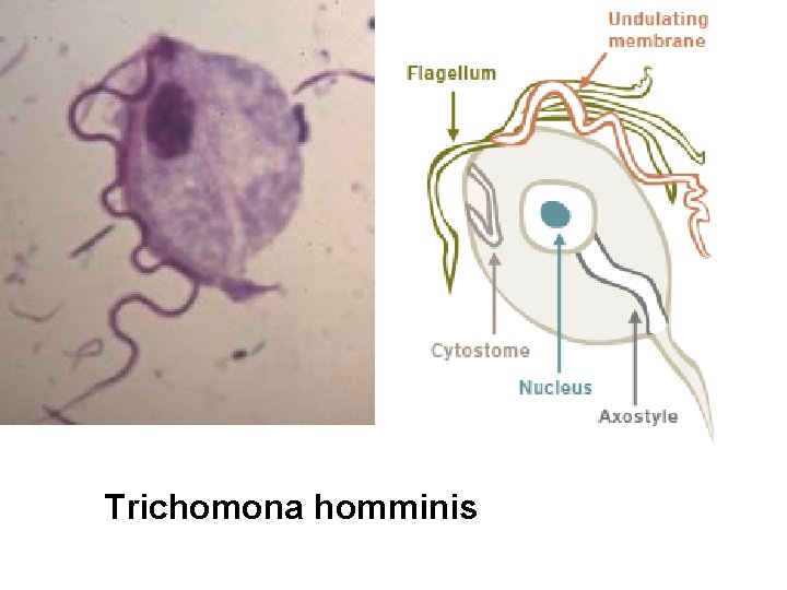 Trichomona homminis 