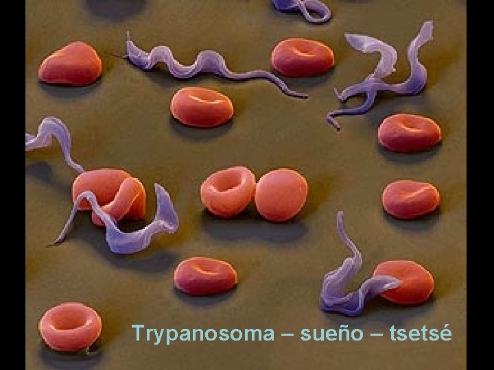 Trypanosoma – sueño – tsetsé 