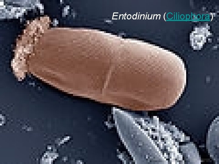 Entodinium (Ciliophora) 